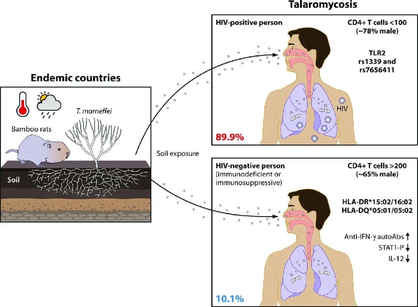 Talaromycosis: Một trong nhưng nguyên nhân hàng đầu dẫn đến tử vong ở người HIV